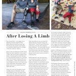 Moving Forward in Life After Losing a Limb